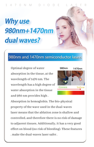 <span class=keywords><strong>Meilleur</strong></span> prix, appareil laser diode Endo indolore 980 1470 nm, traitement des mycoses des <span class=keywords><strong>ongles</strong></span> des pieds, <span class=keywords><strong>produit</strong></span> de beauté et de soins personnels - Product Image 6