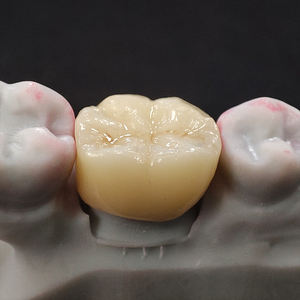 Tutti i denti di porcellana ceramica Zirconia corone impianto dentale produttore cina buon prezzo - Product Image 5