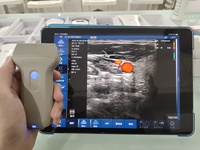 Sonde d'échographie sans fil à 256 éléments |   Échographe portable à ultrasons avec imagerie en temps réel pour diagnostic clinique