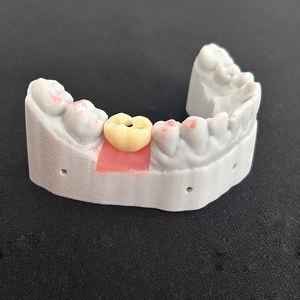 Prothèses dentaires pour implants dentaires Couronnes en zircone à vis <span class=keywords><strong>molaire</strong></span> unique Prix bon marché pour laboratoires et cliniques dentaires - Product Image 5