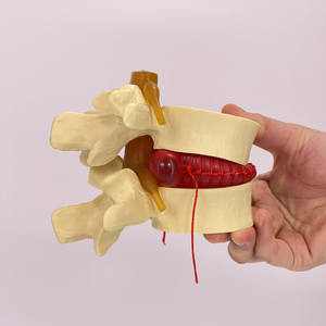 Lumbar Spine Model Intervertebral Disc Model Diseased Lumbar Spine Model - Product Image 4