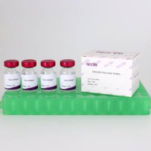 Antigène multivalent prêt à l'emploi pour le test de plaque rapide typhoïde Pullorum et volaille (certifié ISO) - Product Image 4