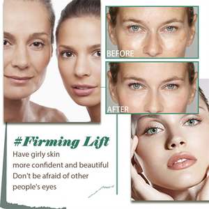 <span class=keywords><strong>Crema</strong></span> Facial Antiarrugas Instantánea OUHOE con Retinol, <span class=keywords><strong>Crema</strong></span> Hidratante para Eliminar Arrugas, <span class=keywords><strong>Crema</strong></span> de Segunda Generación para Arrugas, Dropshipping - Product Image 4