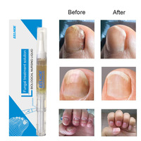Huile Réparatrice pour Ongles EELHOE Marque Privée – Traitement Anti-Fongique pour Ongles Jaunes – Liquide Fortifiant pour Soin des Ongles 3ml – Hydratant Doux pour les Mains