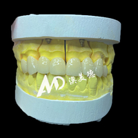 Pont dentaire entièrement en céramique de zircone de haute qualité | Production rapide et ajustement personnalisé