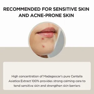 Korean Wholesale Private Label Natural Centella Serum Repair Acne Treatment Soothing Sensitive Skin Care Facial Essence Serum