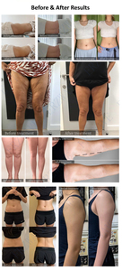 Professional Standing Slimming Fat <b>Burning</b> and Firming Massage <b>Cream</b> with Plastic <b>for</b> Effective Fat Reduction - Product Image 6