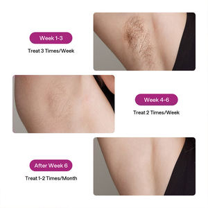 Double impulsion 24J permanent CE USA rasage propre bikini cheveux saphir glace refroidissement sans douleur permanente IPL <span class=keywords><strong>épilation</strong></span> - Product Image 4