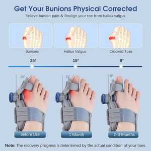 Correcteur d'hallux valgus en gel et séparateur d'orteils pour femmes et hommes - Attelle orthopédique réglable, respirante, pour l'alignement du gros orteil et le soulagement de la douleur - Product Image 4