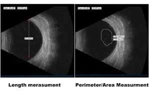 Eye <strong>Scan</strong> Ophthalmic <strong>AB</strong> Ultrasound Scanner Ophthalmic Equipment <strong>AB</strong> <strong>Scan</strong> - Product Image 6