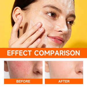 CHIC BEAUTE โฟมล้างหน้าผสมซัลเฟอร์ 10% ช่วย<span class=keywords><strong>ลด</strong></span><span class=keywords><strong>สิว</strong></span> ฟื้นฟูผิว กระชับรูขุมขน ควบคุมความมัน สำหรับผิวหน้าและผิวกาย - Product Image 4
