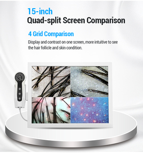 HD 15 Zoll Bildschirm Haarfollikel Kopfhaut Scanner Detektor Haarana lysator Haut Kopfhaut Haar analyze gerät - Product Image 2