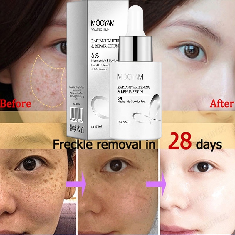 aobenz anti spot serum