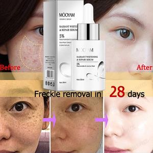 Whitening Serum Voor Gezicht Anti-Donkere Vlekken Gezicht Vochtinbrengende Huid Verheldering <span class=keywords><strong>Nicotinamide</strong></span> Serum Anti Spot Face Serum - Product Image 2