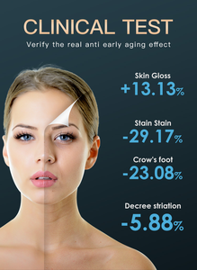 Revitalize Skin SpectrumRejuvenating Instrument Embellece la piel y elimina el acné Nanómetro de circulación de luz colorida - Product Image 3