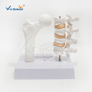 Modèle d'ostéoporose VIC-V45 (2 parties), modèle de maladie, modèle d'anatomie squelettique de la colonne vertébrale humaine - Product Image 5