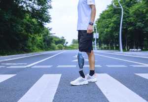 Articulation du genou intelligente avancée pour les amputés trans-fémoraux Prothèse de genou bionique avec soutien de marche adaptatif multi-terrain - Product Image 4