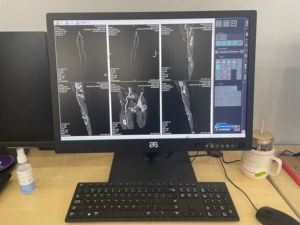 Moniteur médical LCD IPS 27 pouces 8MP DP SDI, état neuf, pour imagerie médicale, utilisation sur ordinateur de bureau, VET - Product Image 2