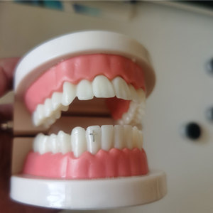 Best Price Medical Pure Titanium Teeth Gems Hot Selling Multi-Purpose Oral Hygiene Jewelry Five Leaf Slover Teeth with Promotion - Product Image 3