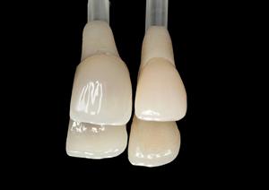 Materiale di resterizzazione estetica del disco di Zirconia dentale multistrato 3D Pro personalizzabile - Product Image 4