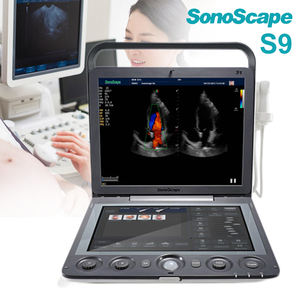 Ecógrafo Sonoscape S9, Sistema de Ultrasonido Doppler Color con Sonda, Ultrasonido Médico de Diagnóstico - Product Image 2