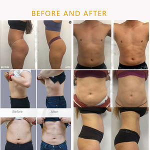 जॉन्टे एम्स सर्कस मांसपेशियों का निर्माण उच्च तीव्रता वाला विद्युत चुम्बकीय शरीर आकार - Product Image 4