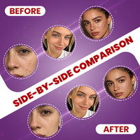 Masque facial LED portable GLPE 3 couleurs, thérapie 630nm, appareil de beauté, soin de la peau, cadeau, vente en gros, livraison rapide, marque privée