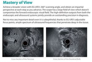 Échographe <span class=keywords><strong>endoscopique</strong></span> radial Sonoscape EUS 360, échographie <span class=keywords><strong>endoscopique</strong></span> 4D, équipement Sonoscape - Product Image 5