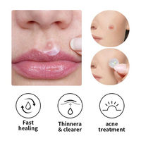 Fournitures de soins de santé spécialisées pour le traitement de l'acné, patch à l'extrait de Centella Asiatica et d'arbre à thé, 100 ml, application détoxifiante pour le visage