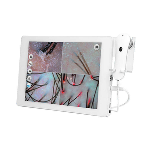 Scalp Analyzer <b>Machine</b> 15 Inch HD Screen Hair Follicle Detection Face <b>Analysis</b> AI Device for Salon - Product Image 5