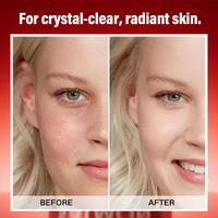 Crème Visage Éclaircissante au Collagène PDRN de Saumon et Rose Marque Blanche – Stimule le Collagène, Atténue les Taches Brunes, Hydratation Profonde en Gel