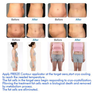 Top Quality Professional Pressotherapy Machine Lymph Drainage Massage Multifunctional Body Shaping Slimming Skin Aanlyzer - Product Image 2