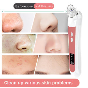 Timesiso 2022 Appareil de soin de la peau électrique à aspiration des points noirs Wifi, santé et beauté, avec stock - Product Image 5