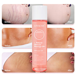 Etiqueta privada Anti Estiramiento Cuerpo Piel Regenerar Reparación Cicatriz Vegano Embarazo Estrías Eliminación Aceite - Product Image 2