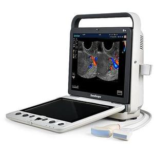 Escáner de Ultrasonido Portátil para Animales Sonoscape S9V de Alto Rendimiento para Diagnóstico en Granjas, Ganado y Clínicas Veterinarias - Product Image 3