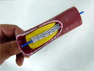 Modèle de stent <span class=keywords><strong>vasculaire</strong></span> modèle <span class=keywords><strong>vasculaire</strong></span> humain enseignement médical humain modèle d'anatomie <span class=keywords><strong>vasculaire</strong></span> pathologique - Product Image 4