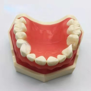 Modèle dentaire supérieur complet Sandra Dental Tw01 <span class=keywords><strong>pour</strong></span> l'enseignement des dents remplaçables - Acier inoxydable et acrylique - Product Image 2