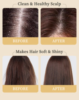 Krim Herbal Ekstrak Tumbuhan Organik Anti-Rontok Penguat Rambut Pengontrol Ketombe Penenang Kulit Kepala Perawatan Rambut Formula 2-IN-1