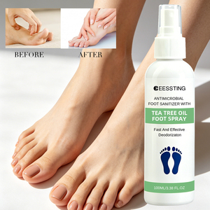 Spray Desodorante para Pies con Aceite de Árbol de Té, 100 ml, Hidratante Natural para Talones Agrietados, Control de Olores, con Logotipo Personalizado - Product Image 1