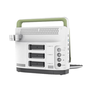 Alta resolución 3D 4D Color Doppler Ultrasonido Echo Máquina Nueva máquina de ultrasonido eléctrica de metal y plástico - Product Image 1