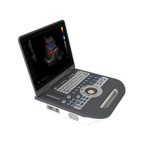LTUB65 - Escáner de Ultrasonido Portátil a Color de Bajo <span class=keywords><strong>Precio</strong></span>, Sistema de Diagnóstico Médico, Máquina de Ecocardiografía - Product Image 3
