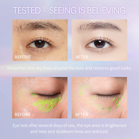 Crème Contour des Yeux Végétalienne au Rétinol HIH Marque Privée, Élimine les Cernes et les Poches, Antirides Anti-Âge, pour le Soin du Visage