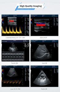 Système d'échographie médicale Doppler couleur 3D CONTEC CMS1700A - Product Image 3