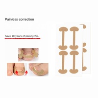 Patch correcteur d'ongles en plastique pour ongles incarnés - Sans colle requise, patch anti-acné personnalisé à Guangzhou