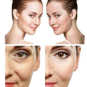 Aceite facial con <span class=keywords><strong>vit</strong></span> c y cúrcuma para blanquear y aclarar la piel, venta al por mayor - Product Image 4