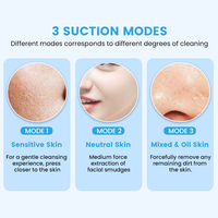 Appareil de nettoyage des pores du visage rechargeable à 6 têtes d'aspiration, outil de nettoyage en profondeur des pores, aspirateur de points noirs, machine d'élimination des comédons