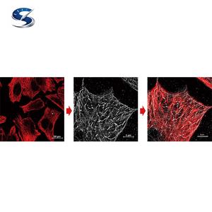 El Sistema de Superresolución N-STORM Ofrece Diez Veces Más Resolución que los Microscopios Ópticos Estándar - Product Image 6