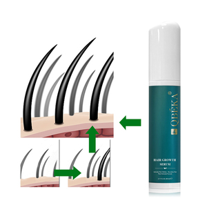 Spray de suero <span class=keywords><strong>para</strong></span> el crecimiento del <span class=keywords><strong>cabello</strong></span> QBEKA, tratamiento herbal de acción rápida que estimula la actividad, estimula el crecimiento del <span class=keywords><strong>cabello</strong></span> y engrosa el <span class=keywords><strong>cabello</strong></span> fino - Product Image 5