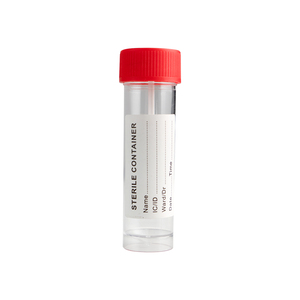 Recipiente para Recolección de Muestras de Uso Médico, Vaso de Muestreo de 30 ml con Cuchara para Orina, Heces, Investigación de Laboratorio - Product Image 3