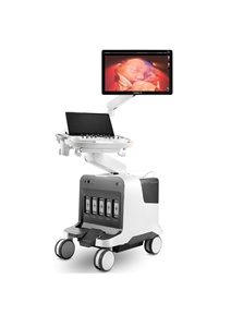 Échographe Doppler Couleur 3D/4D Professionnel SonoScape Propet 80 de Haute Qualité avec Logiciel Vétérinaire pour Hôpitaux et Cliniques - Product Image 4